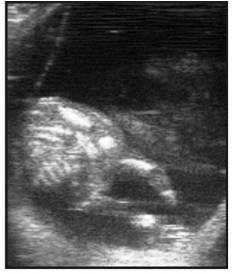 Día 55: embrión con costillas y miembros posteriores.