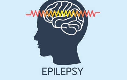 Epilepsy