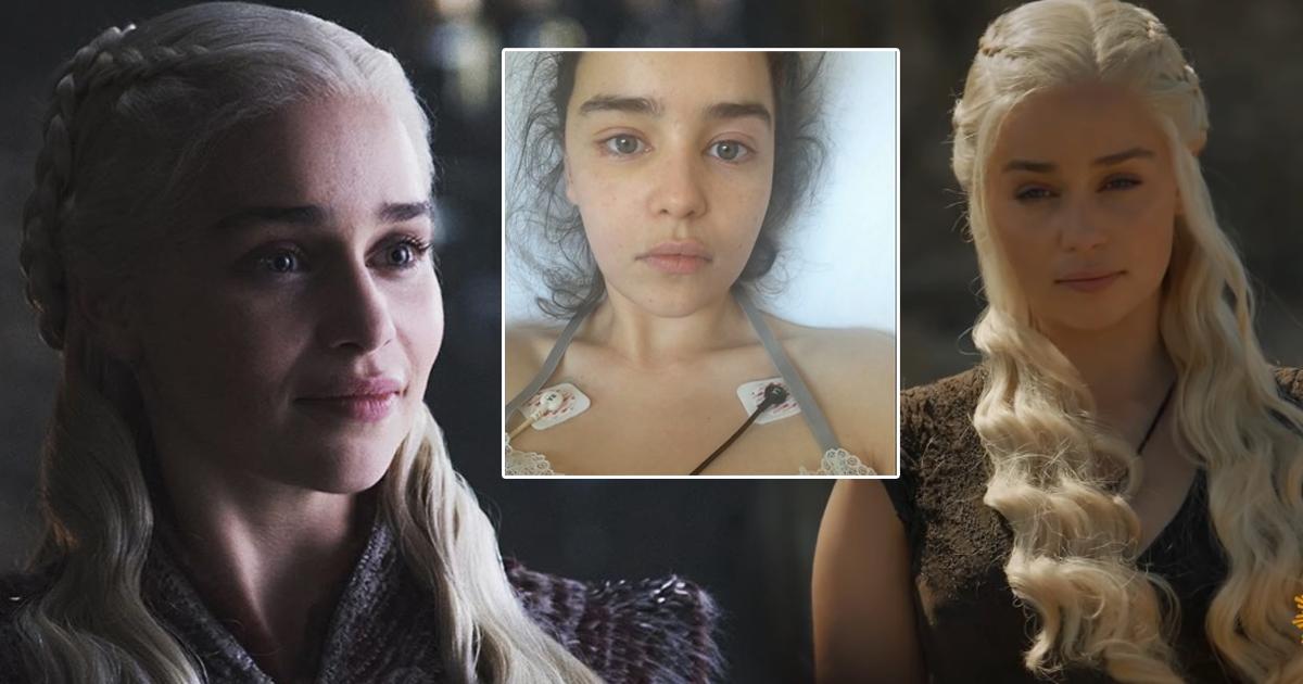 เอมิเลีย คลาร์ก อดีตแม่มังกรสุดแซ่บแห่ง game of thrones4