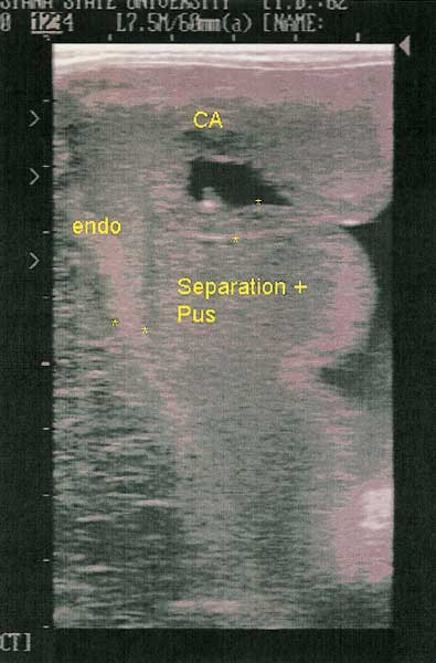 Ultrasonographic image of the caudal reproductive tract in a mare in late gestation. 