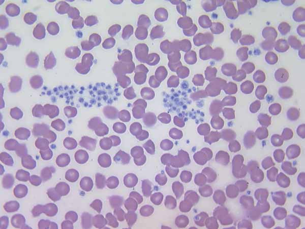 Clumped canine platelets (center) generally indicative of poor ex vivo anticoagulation (50x).