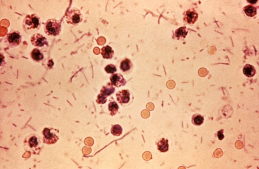 A microscopic picture of Shigella Bacteria