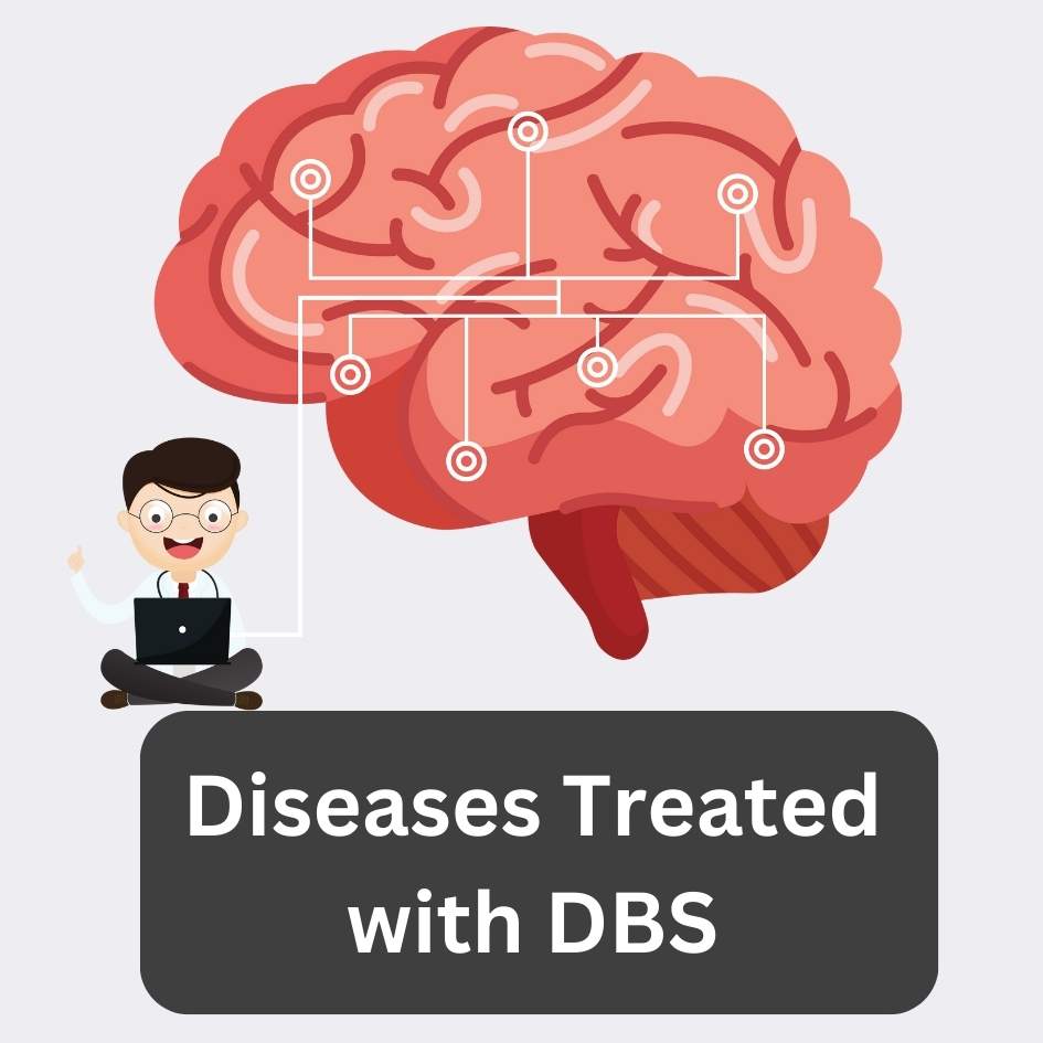 Diseases Treated with DBS In India 