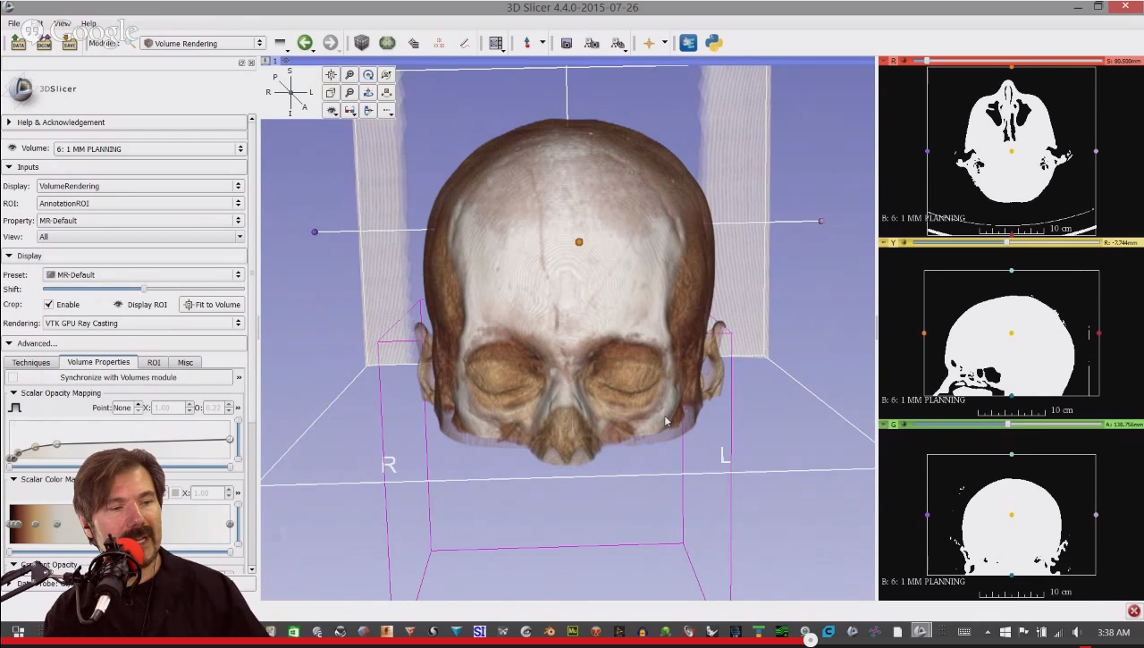 2015.07_3DSlicer-AllThings3D_podcast_HighResCT_VolumeRendering_2.png