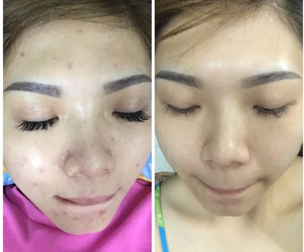 Review Công Dụng Và Nơi Mua Viên Uống Vitamin E 400 Iu Của Mỹ