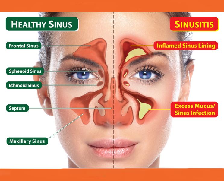 sinus.jpg