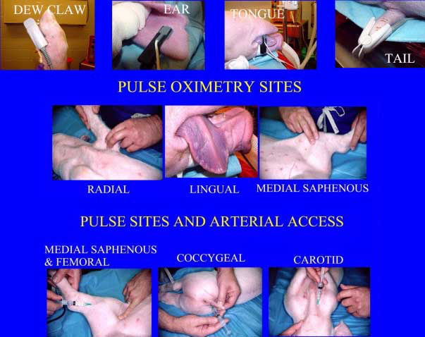 Arterial access sites. 