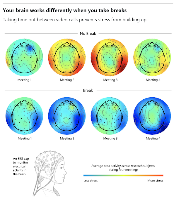 brain-Needs-Breaks