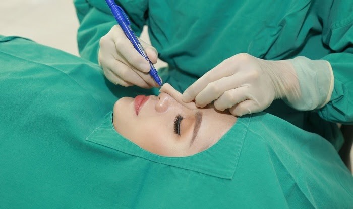 Nâng mũi uy tín hiện đang là từ khóa đang được tìm kiếm nhiều nhất trong các vấn đề liên quan đến phẫu thuật thẩm mỹ nâng mũi.