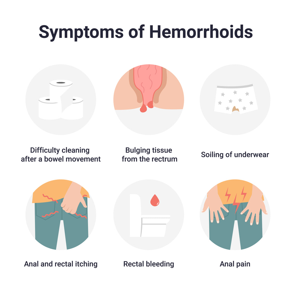 Symptoms of Hemorrhoids Infographic