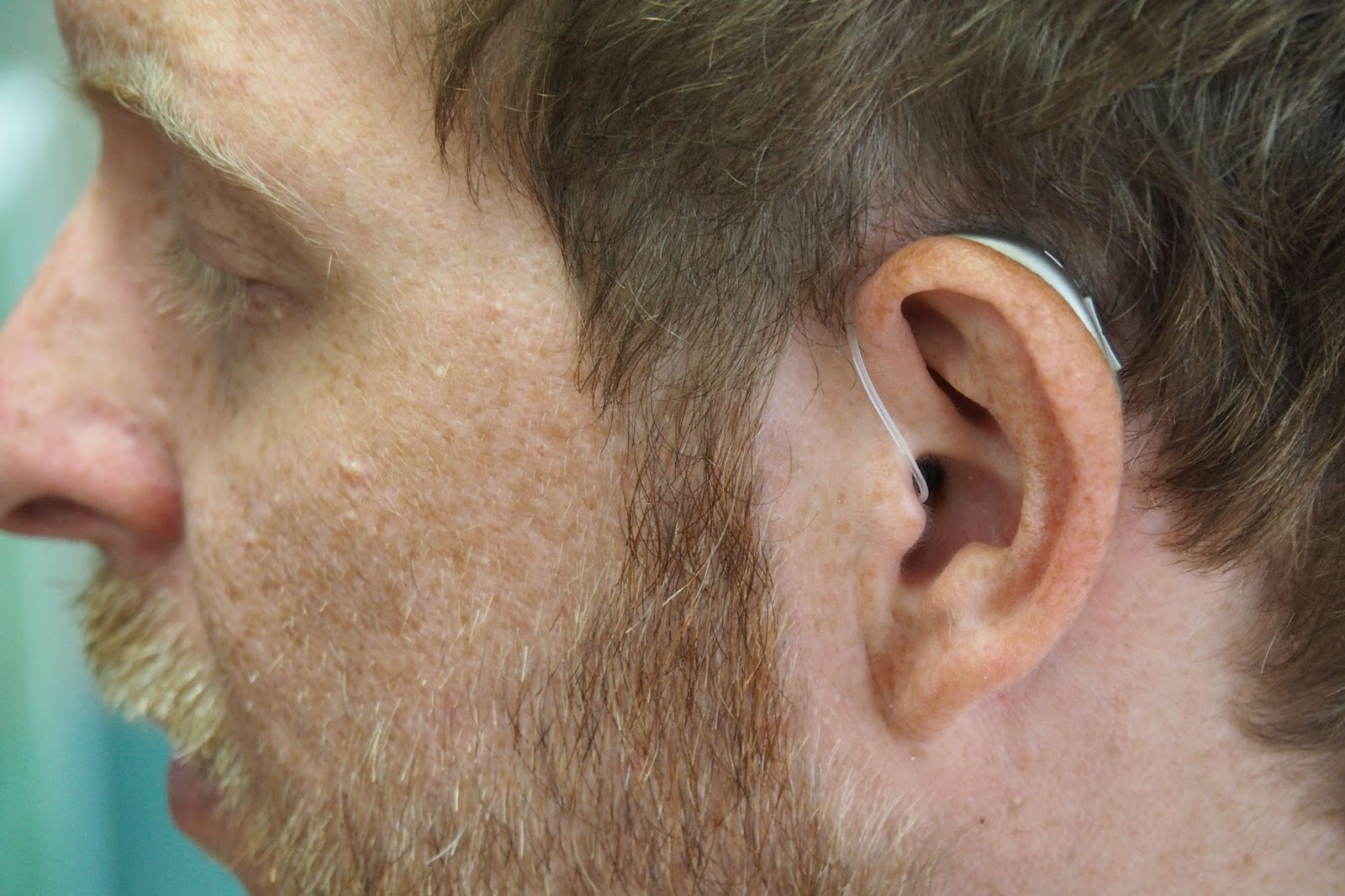 man with hearing aid, hearing loss, deaf, sound