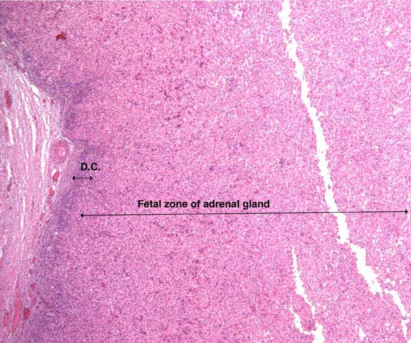 The adrenal gland of the sloth has a striking 'fetal zone' that disintegrates after birth