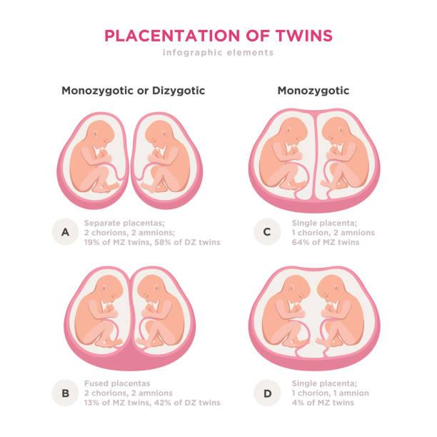 211 Twin Pregnancy Illustrations & Clip Art - iStock