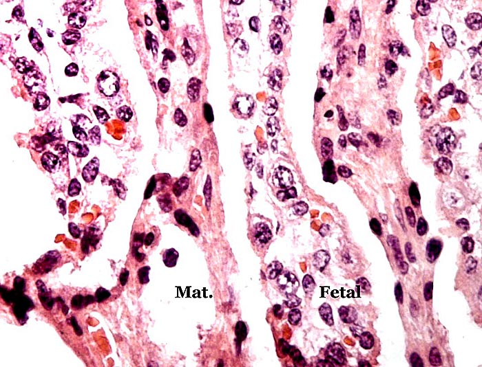 Interspersion of villi (Fetal) with maternal (Mat.) parenchyma