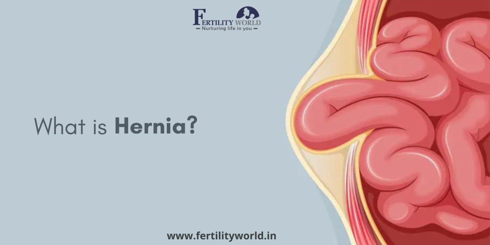 Hernia