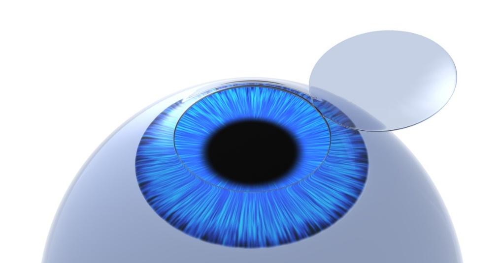 A Clear Look at the LASIK Flap: Recovery, Complications, FAQ