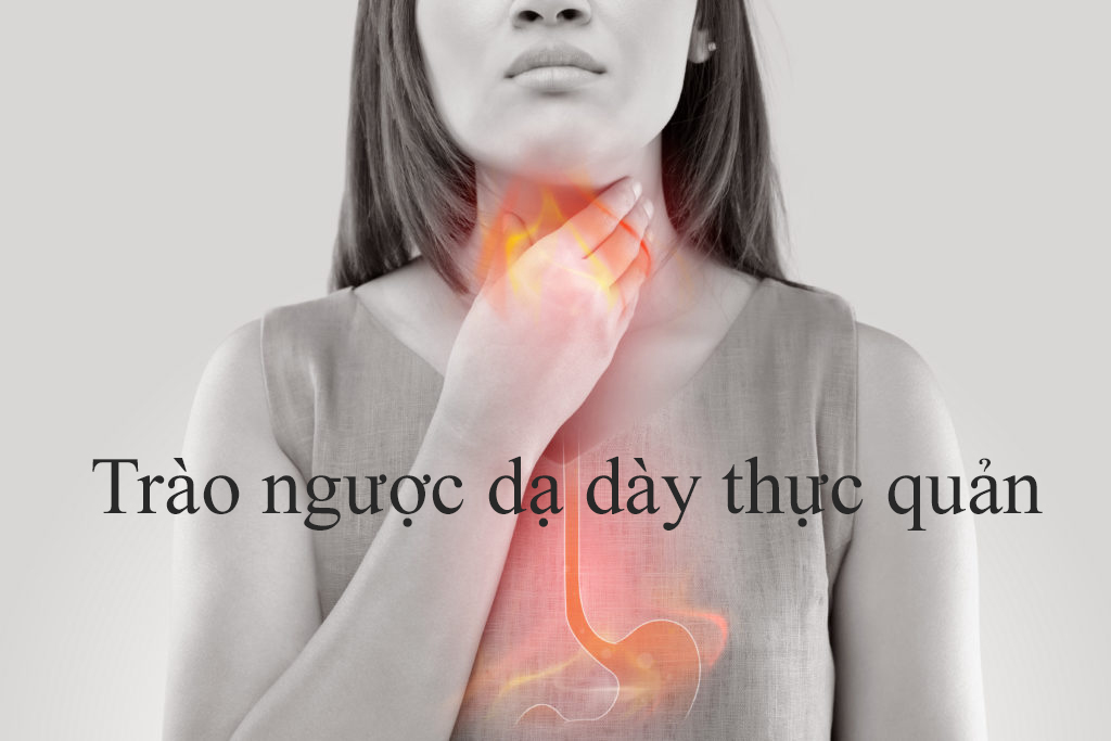 Trào ngược dạ dày thực quản