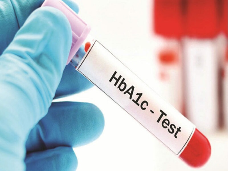HbA1c - Chỉ số vàng trong theo dõi, kiểm soát đường huyết.