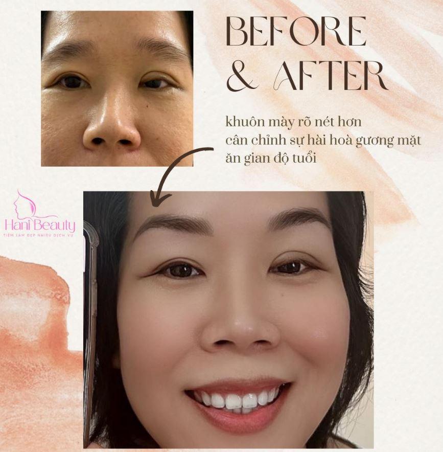 https://lh5.googleusercontent.com/VyASVHDKGDA0NjXLJcz3sBDmtem-mhs30Ig4VYqGovQJxQ90I5fqDCHqM75cIB30C-ft8ECoDEW0D3zmclhtNNhcsCUeW98U0rsW6OtXkgD-04IOc8T35mWKkaxn4gGJbuCrvP908bLStzg
