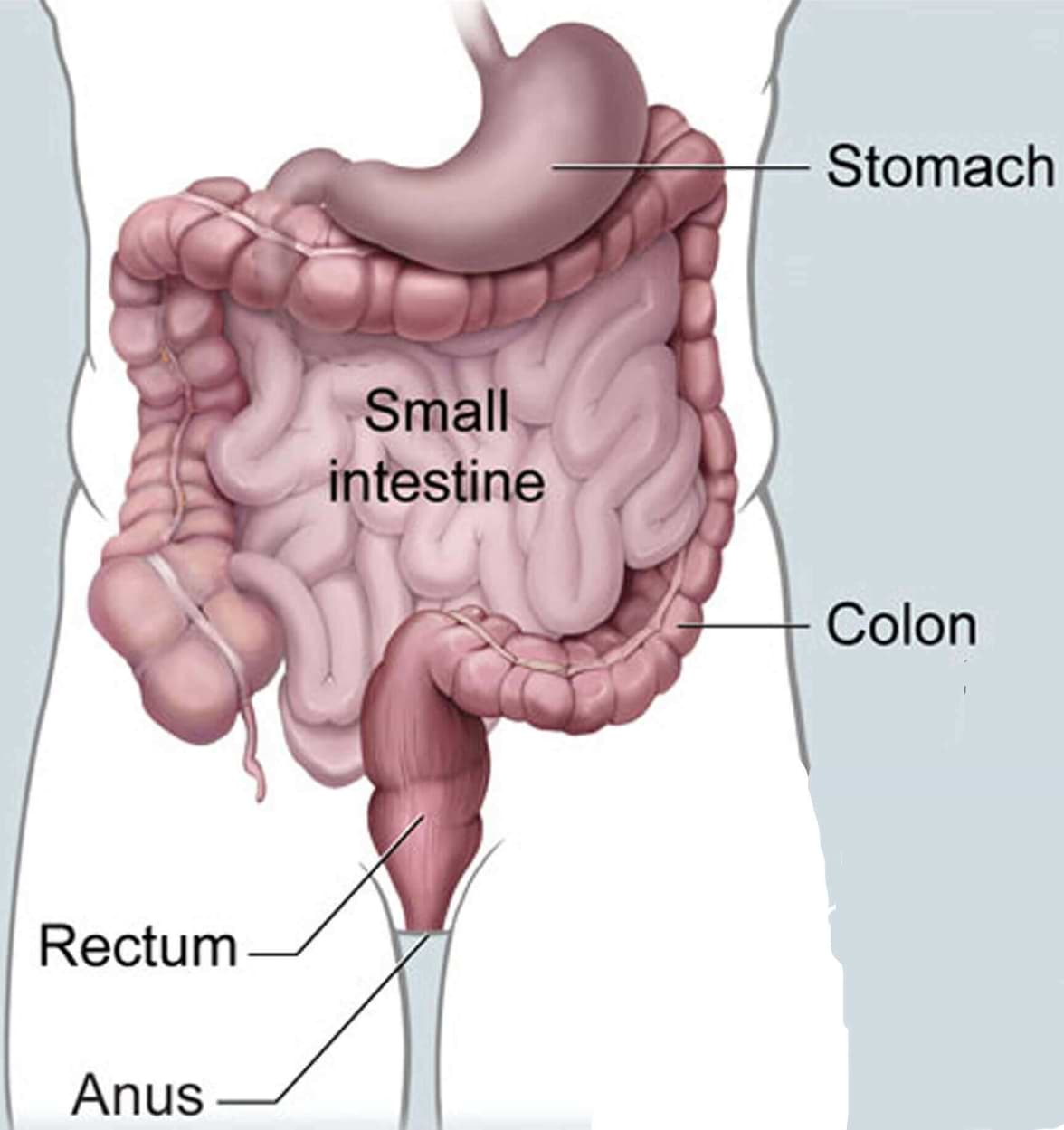 Colon-rectum cancer