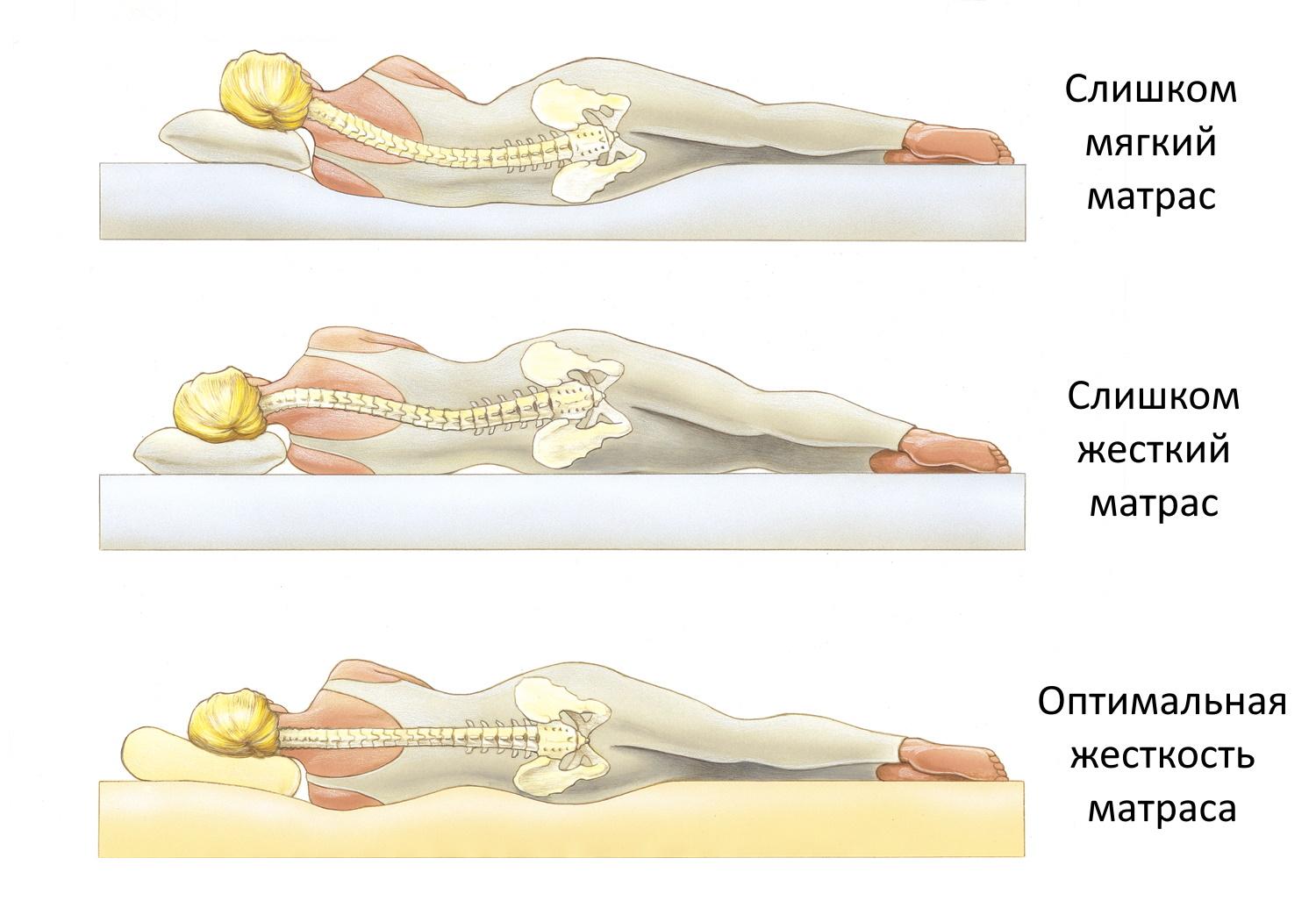 Жесткий матрас для спины. Ортопедический матрас позвоночник. Правильный ортопедический матрас. Правильный матрас для спины. Позвоночник на матрасе.