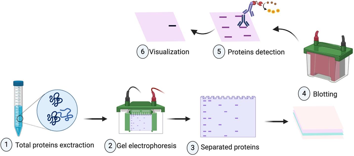 Applications of western blot technique: From bench to bedside - Meftahi -  2021 - Biochemistry and Molecular Biology Education - Wiley Online Library