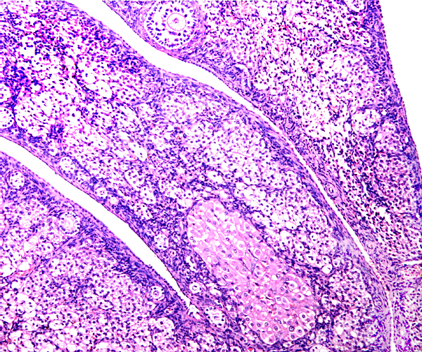 Higher magnification of the ovary with one Graafian follicle (on top), a large number of oocytes, and one corpus albicans.