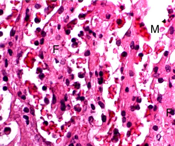 Section through the trabecular labyrinth with mesenchyme of villi (F) and maternal blood (M)