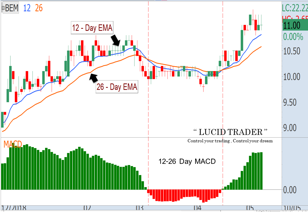 MACD