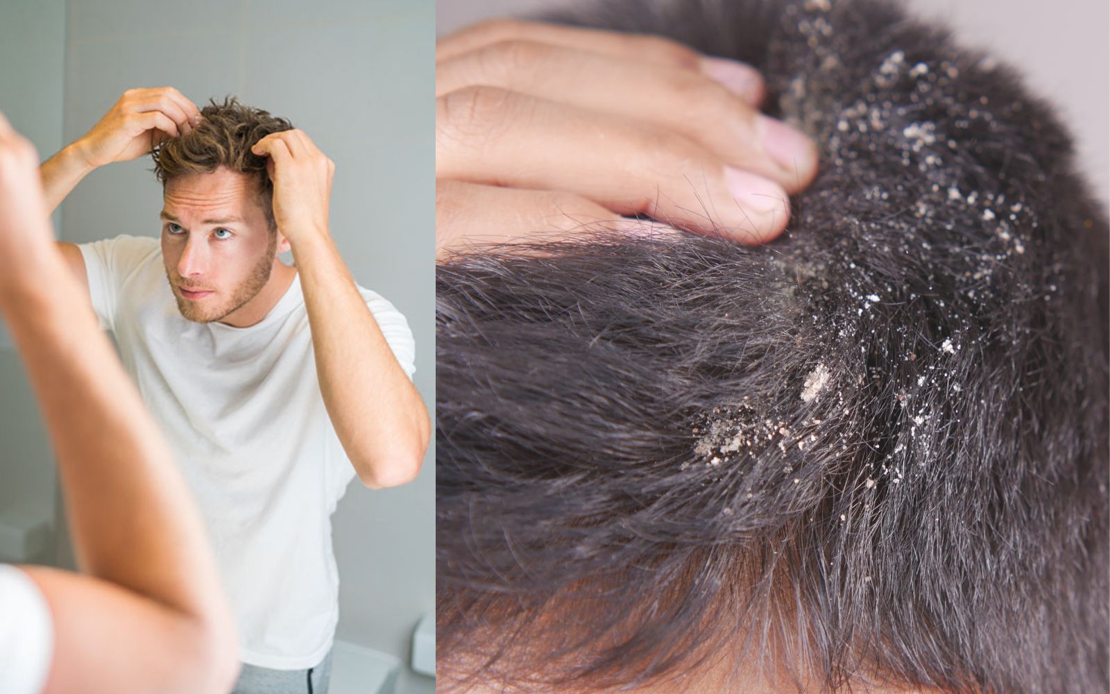 What Dry Hair Looks Like: Key Signs