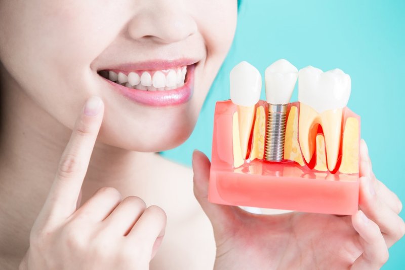 Cần tuân theo hướng dẫn chăm sóc răng miệng của bác sĩ sau khi cấy Implant