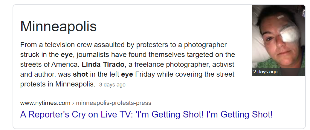 Minneapolis. From a television crew assaulted by protesters to a photographer struck in the eye, journalists have found themselves targeted on the streets of America. Linda Tirado, a freelance photographer, activist and author, was shot in the left eye Friday while covering the street protests in Minneapolis. 