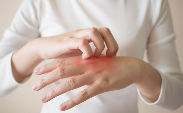 Người bệnh thường bị đau và ngứa ran ở gần ngón cái