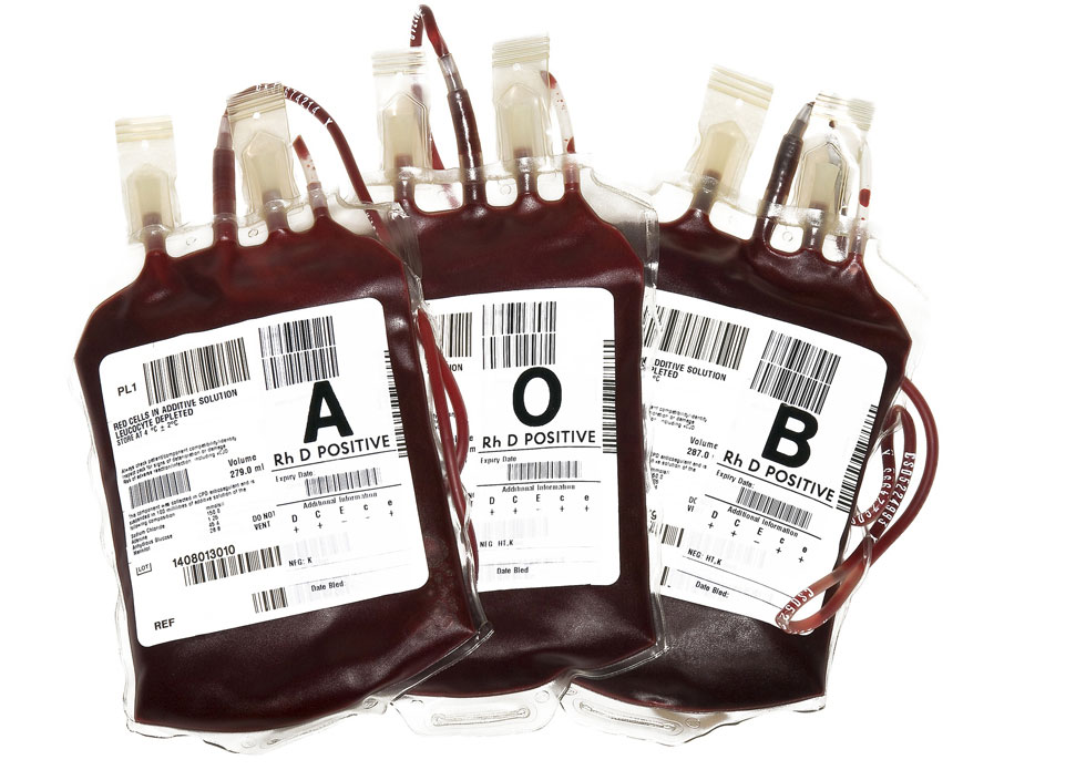 Plaquetas globulares o sangre total en pequeñas cantidades