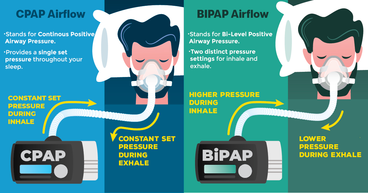 Types of cpap/bipap in India