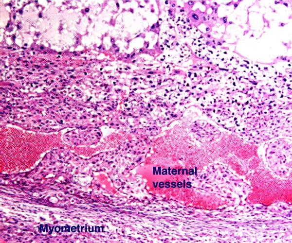 Floor of 18dpc mouse placenta with two regions of trophospongium