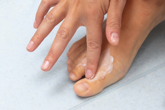 A closeup view of a caucasian person massaging moisturizing cream into the top of the bare foot and toes skin health and dermatology concept