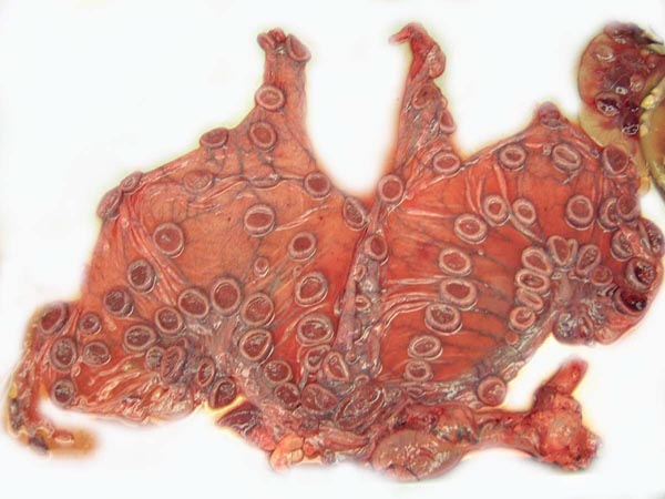 Uterus of same ibex with placenta and fetuses removed. Note the rows of maternal caruncles