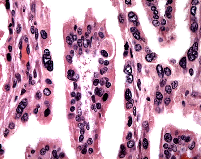 Villus (center) between maternal endometrial tufts