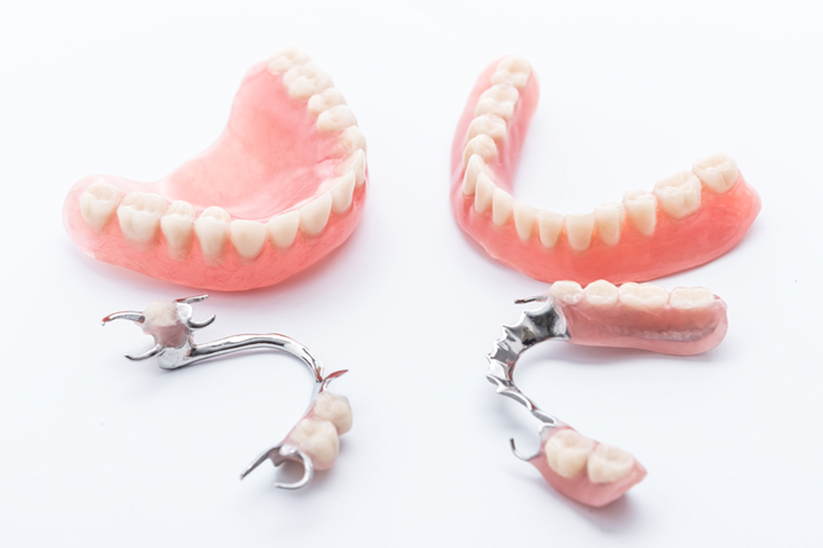CẤY GHÉP IMPLANT CÓ GÌ KHÁC SO VỚI CÁC PHƯƠNG PHÁP PHỤC HÌNH RĂNG ...