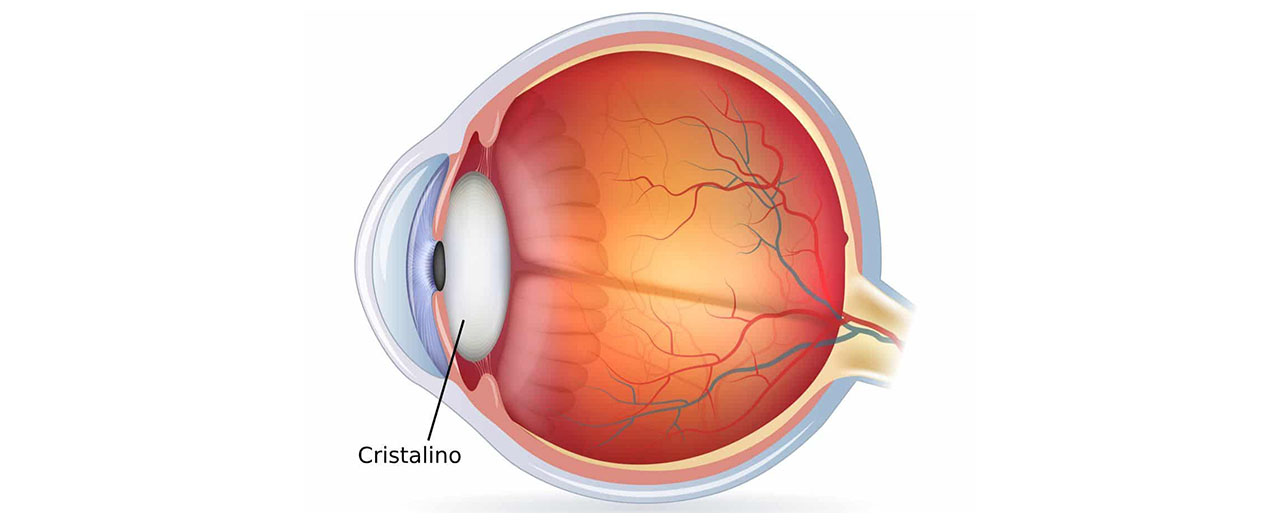 cristalino-lente-dentro-del-ojo-optimania