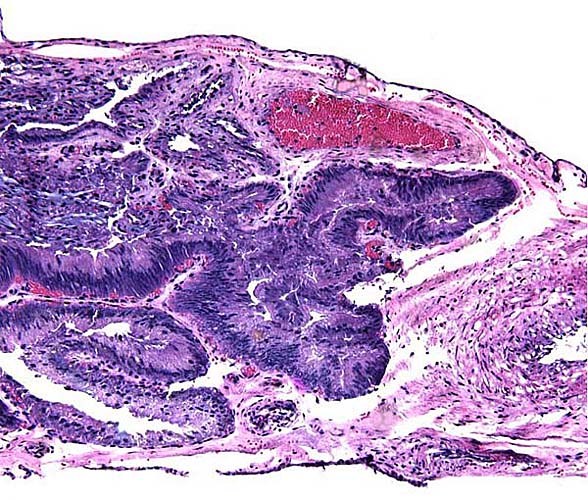 At the placental edge the trophoblast has a much more cylindrical appearance