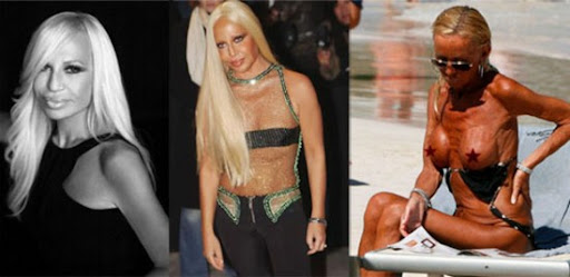 donatella versace surgery. Donatella Versace