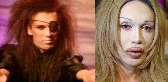 pete burns before and after. Pete Burns