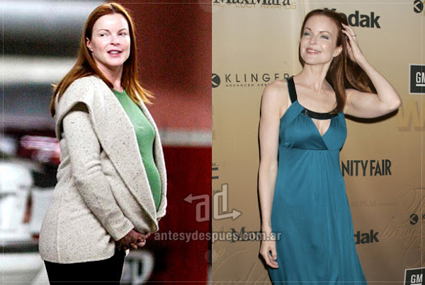 Before and after of Marcia-Cross embarazada