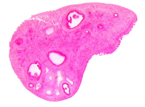 Immature neonate ovary with follicular development (2 ms.)