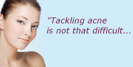 acne skin care treatments