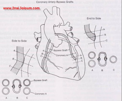 patho cardio vasculaire 8