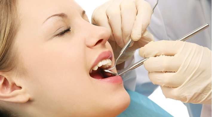 Cạo vôi răng có ảnh hưởng gì, không nên làm gì?