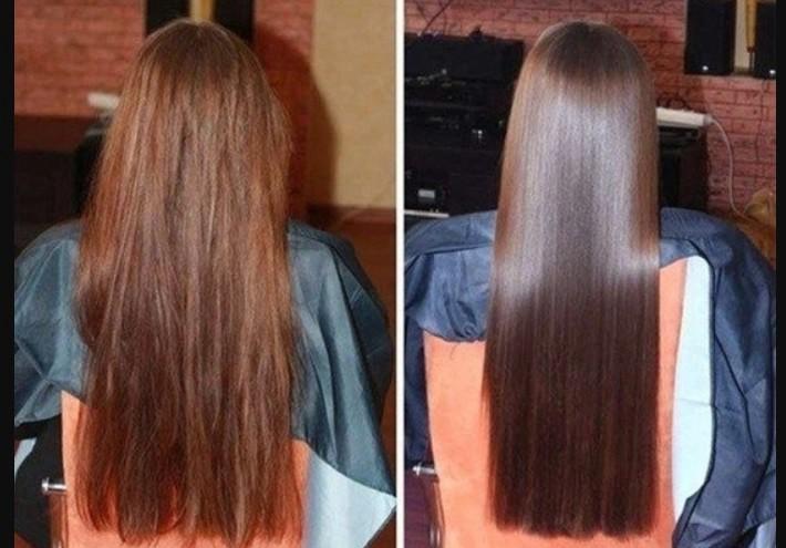 before and after photos of using apple cider vinegar
